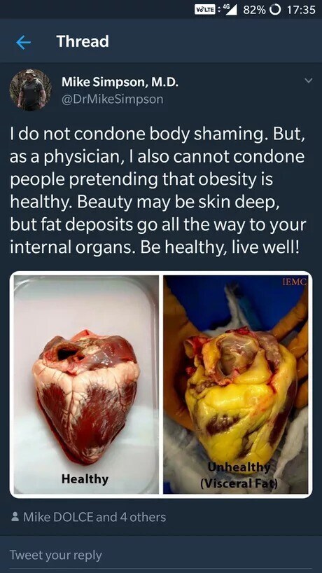 한번 찌면 잘 안빠진다는 이소성 지방_1.jpg