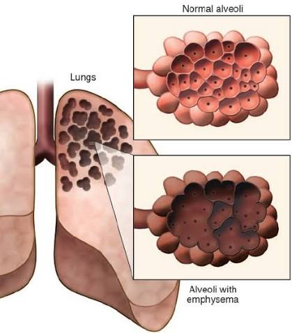 약혐] "수술하지 않으면 죽지만, 수술을 해도 죽소"_3.jpeg