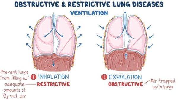 약혐] &quot;수술하지 않으면 죽지만, 수술을 해도 죽소&quot;_2.jpg