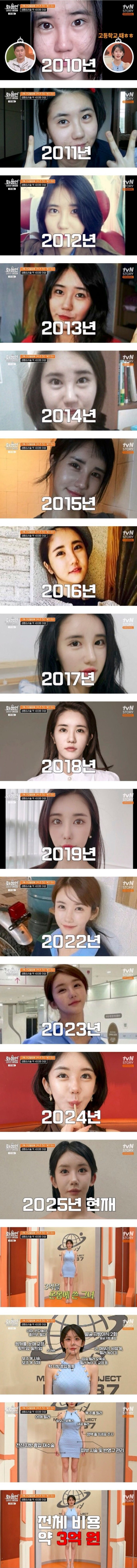 성형에 3억을 쓴 ㄷㄷㄷ_1.jpg