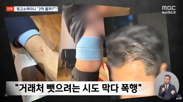 기자님 때문에 인생 망쳐‥호카 